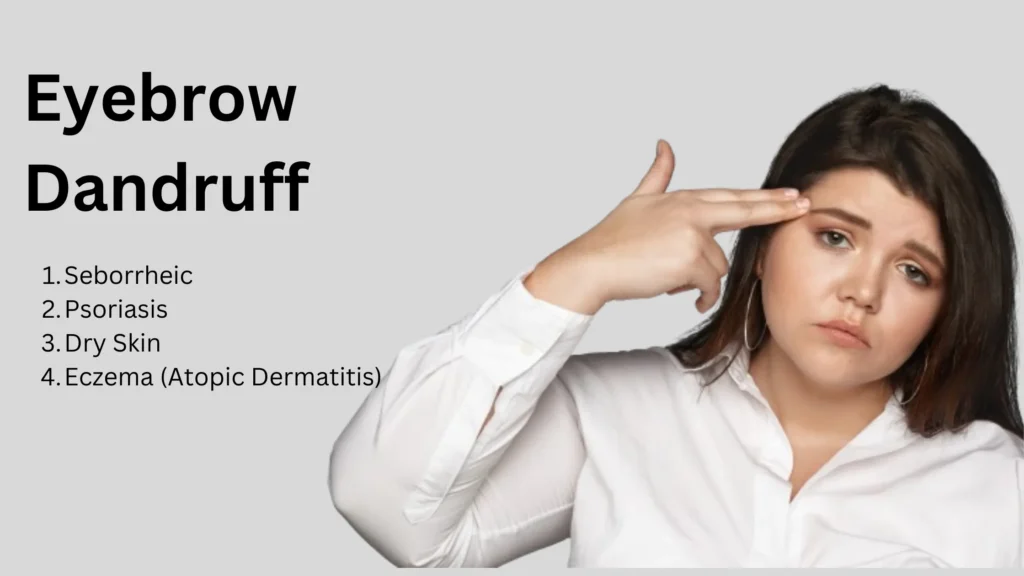 Eyebrow Dandruff Cause Hair Loss