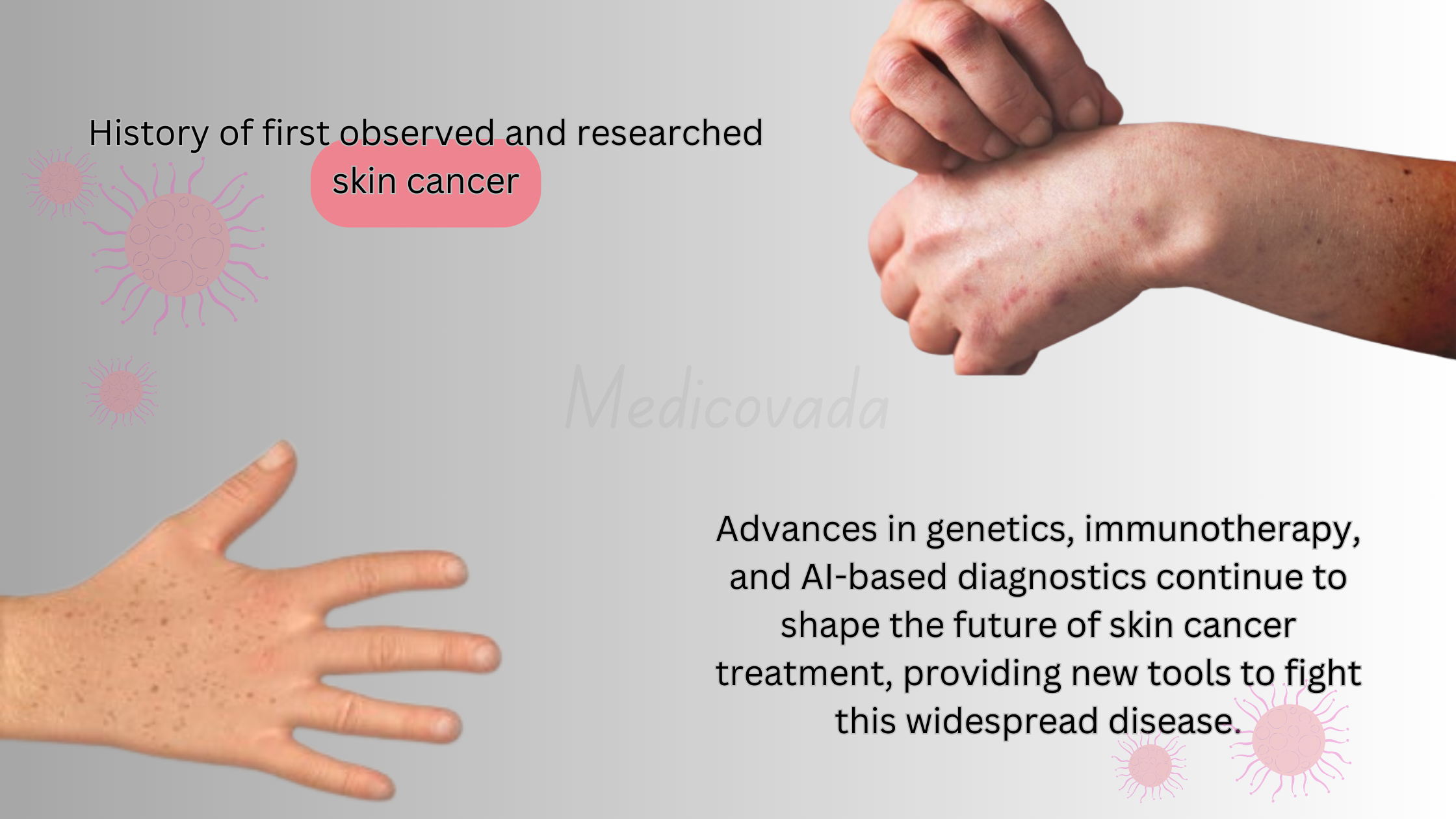 Who first observed and researched skin cancer?