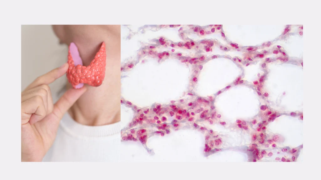 Understanding Blood Cancer in Humans: A Support Guide