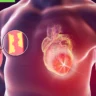 10 Tips for Angina: A Heart-Healthy Approach