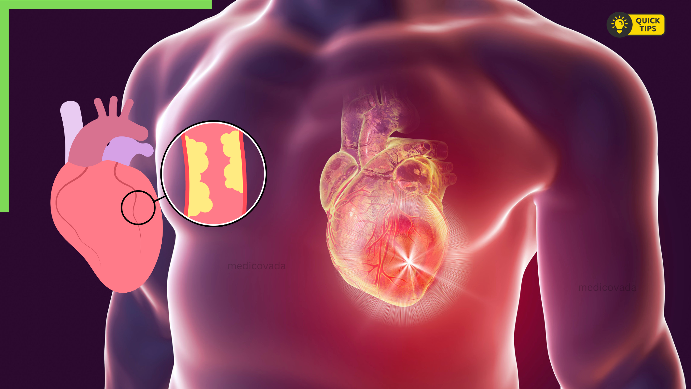 10 Tips for Angina: A Heart-Healthy Approach