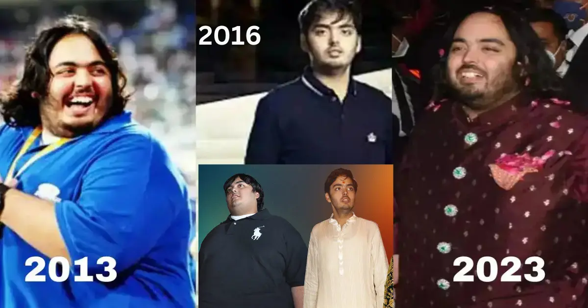 What disease does Anant Ambani have