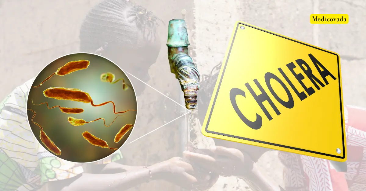 Cholera: Causes, Symptoms, Prevention & Control: A Must-Know Guide for Pharmacy Students